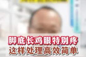 脚底长鸡眼，为什么，怎么办？#鸡眼 #脚痛 #骨科陈超 #扁平足 #老茧视频封面