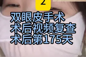 双眼皮术后170多天恢复记录 #双眼皮 #双眼皮蜕变记 #双眼皮恢复记录 #双眼皮手术 #郑州双眼皮李朋杰视频封面