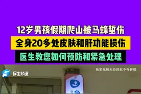 12岁男孩假期爬山被马蜂蜇伤，全身20多处皮肤和肝功能损伤，医生教您如何预防和紧急处理#常识中国视频封面