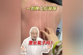 晚上后背特别痒，经常让对象帮你抓，可是抓烂了还是痒，这可能是#干性湿疹 #抖出健康知识宝藏  #涨知识 #湿疹 #情侣视频封面