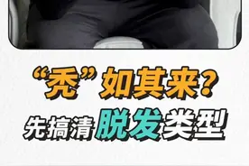 “秃”如其来？先搞清脱发类型！（央视频号：#央视财经中国好医生  ）