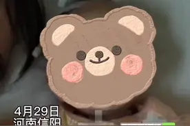 4月29日，河南信阳。“孩子现在眼睛不会动了！” 9个月男童蒙被子时间过长，导致呼吸衰竭、颅内损伤#孩子 #危险瞬间 #眼睛 #河南dou知道 视频封面