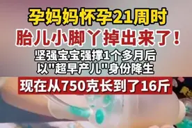 孕妈妈怀孕21周时，胎儿小脚丫掉出来了！坚强宝宝以"超早产儿"身份降生，现在从750克长到了16斤。