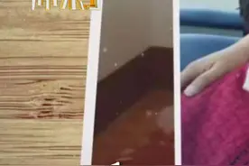 8岁患上皮肤病，女子20多年来过得好憋屈#皮肤病  #憋屈 #谢谢你来了 @谢谢你来了-超级播