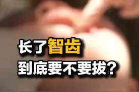 长了智齿到底要不要拔？ #智齿
