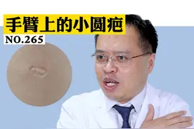  你知道你手臂上的这个小圆疤是怎么来的吗#科普 #涨知识 #冷知识 视频封面