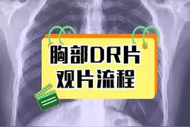 胸部DR片观片流程 #医学影像 #医学生 #胸片 #肺炎 #支原体肺炎视频封面