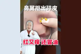 鼻翼两侧冒油，又红又痒的，教你处理#脂溢性皮炎 #医学科普 #皮肤视频封面