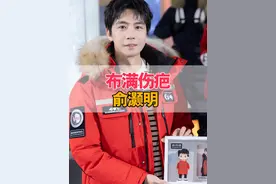 被一场爆炸戏断送花美男之路，下巴至今布满伤疤的俞灏明，生活怎么样了？#俞灏明 #王晓晨 #俞灏明烧伤毁容 #俞灏明王晓晨 #一起来看流星雨视频封面