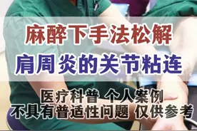 麻醉下手法松解，肩周炎的关节粘连 #肩周炎 #肩部疼痛 #肩膀疼 #肩周炎无痛松解 #骨科许建中教授