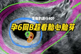 孕6周B超 看胎心胎芽 | 生命的进化01 #怀孕那些事 #孕期知识视频封面