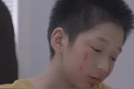 #亲爱的生命 一种传男不传女的X基因隐性遗传病——自毁容貌综合症   视频封面