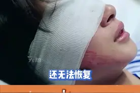 戴隐形眼镜真的要注意啊#隐形眼镜 #女生 #注意 #今日分享