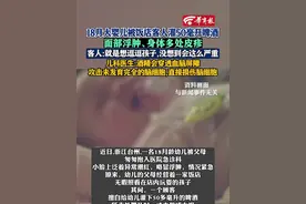 18月大婴儿被饭店客人灌50毫升啤酒，面部浮肿、身体多处皮疹，客人:就是想逗逗孩子,没想到会这么严重