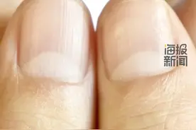 指甲起竖纹是肠胃不好？“月牙”越多越健康？ #科普 #科普一下 #健康科普 #美甲 #指甲