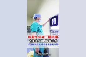 股骨头坏死三期早期 ，选择进行微创保髋手术，手术顺利完成 #健康 #骨坏死视频封面
