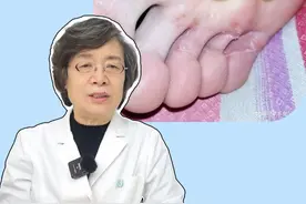 脚趾或脚底长很痒的小水泡，这是真菌感染的表现，医生教你一个小妙招#医学科普 #健康 #传染 #脚气 #盐酸阿莫罗芬视频封面