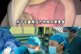 女性中重度压力性漏尿、尿失禁怎么办？ #河南 #漏尿盆底肌松弛 #尿失禁手术 #女性健康视频封面