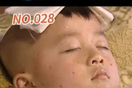 天花是什么？它跟水痘是一种东西吗？胳膊上打的疫苗是天花疫苗吗？#天花 #水痘 #医学科普 视频封面