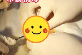 纯手工包皮手术全过程 #男性健康 #手术日常 #硬核健康科普行动 #知识分享视频封面