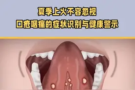如何辨识夏季上火导致的口疮咽痛及其常见表现 如何辨识夏季上火导致的口疮咽痛及其常见表现