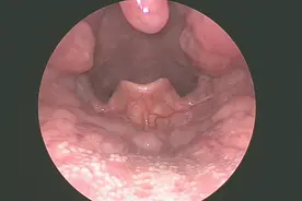 认识一下小舌头
#医学科普 #健康科普 #医学常识 #人体视频封面
