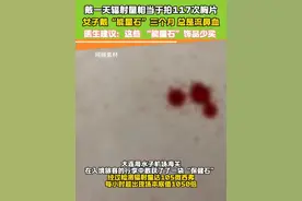 医生建议：这些爆火的“能量石”饰品少买！#饰品 #致癌 #健康 #能量石带一天相当于做百次胸片