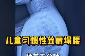 儿童习惯性耸肩塌腰 睡前五分钟 练这三个动作 ！ #塌腰 #不良体态 #含胸驼背 #肩膀内扣 #硬核健康科普行动视频封面