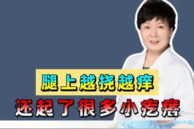 腿上越挠越痒 还起了很多小疙瘩 #医学知识科普