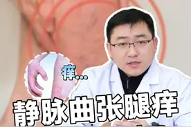 静脉曲张腿痒是怎么回事？ #静脉曲张 #静脉曲张症状 #医学科普 #抖出健康知识宝藏视频封面