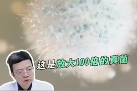 让你脚趾缝发痒发臭的罪魁祸首像棉花糖？教你两步对付它#真菌#脚气 #脚臭 #脚痒 #回南天 #抖出健康知识宝藏