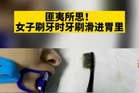 #女子仰头漱口把15厘米牙刷吞到胃里真是令人匪夷所思！#奇葩 