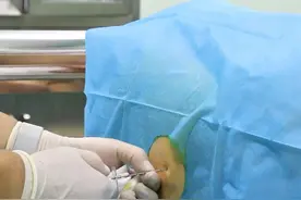 剖腹产麻醉全过程!插入腰椎的钢针居然长达10CM! #剖腹产 #手术 #孕产知识 #怀孕视频封面