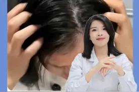 早上刚洗完头晚上就又油又塌？医生来帮你拯救头油 #头油  #控油洗发水 #皮肤   #苦参碱洗头水