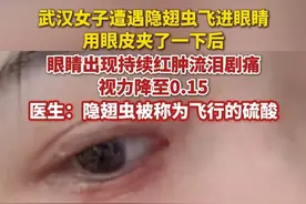 武汉女子遭遇隐翅虫飞进眼睛，用眼皮夹了一下后，眼睛出现持续红肿流泪剧痛，视力降至0.15。（九派新闻）视频封面