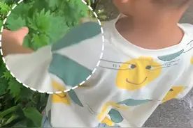 荨麻草，咬人草！据说是云贵川孩子的#童年回忆！来源@强壮的展展妈🐟 #荨麻 #皮肤科 #医学科普