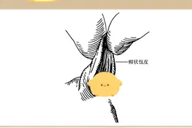 尿道下裂的3个典型症状，快给宝宝自查一下吧~#医学科普 #尿道下裂 #儿科医生 #硬核健康科普行动视频封面