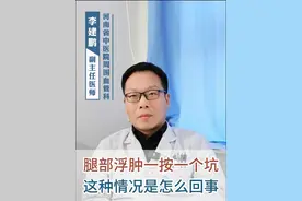 腿部浮肿一按一个坑这是怎么回事 腿部浮肿一按一个坑这是怎么回事#入冬换季不患疾 #硬核健康科普行动 #李建鹏 #腿部一按一个坑 #浮肿 