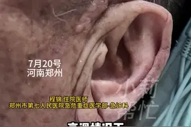7月20日，河南郑州。爸妈夏天偷偷关空调：我不热，扇扇子就行！医生：气温超过38度一定要开空调！老年人对温度感知能力偏低 更易中暑！#不一样的中国节气  #中国节气大暑篇