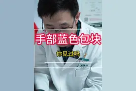 手部的“蓝色小包包” #医生日常  #门诊案例 #热点 #囊肿 #硬核健康科普行动视频封面