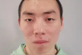 宁波寻亲：青年男子被长期救助，自述叫熊赞，疑似安徽阜阳或安徽滁州人图片