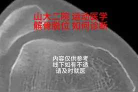髌骨脱位如何诊断? #髌骨脱位 #山东大学第二医院视频封面