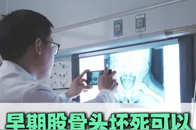 早期股骨头坏死可以做,prp微创保髋减压手术 #股骨头坏死 #PRP技术 #硬核健康科普行动  #微创保髋视频封面