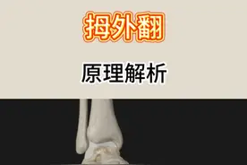 拇外翻有什么危害 拇外翻是怎么形成的#运动解剖 #人体结构 #科普一下 #拇外翻 #干货分享视频封面