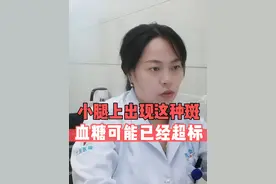 小腿上出现这种斑，血糖可能已经超标 #糖尿病科普 #硬核健康科普行动  #秋季为健康迈步视频封面