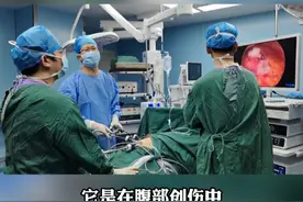 腹部创伤，腹腔镜下探查发现胰腺周围有渗出血#腹腔镜 #胰腺 #手术室日常 #普外科杨文辉视频封面