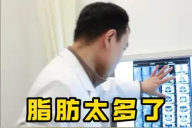 什么是#硬膜外脂肪增多症 #腰椎术后 #俊松医生说脊柱 #硬核健康科普行动  #医疗健康创作训练营视频封面