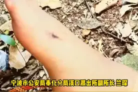 #浙江宁波 男子外出踏青被#五步蛇 咬伤，有剧毒！