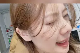 女生不小心撞到鼻子 鼻骨骨折 不敢做手术 消肿后竟然有了高鼻梁 当事人：直接美出新高度  整容医生： 骨折断口处有增生 可能会使鼻子变高 网友：比整容都自然！来源@王姐（小豌豆） #鼻子 #整容 #万万想不到 #江苏dou知道视频封面