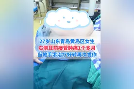 耳前瘘管术后一个月复发，每次切排治疗拖了8年之久#医学科普 #耳前瘘管 #硬核健康科普行动  #武汉陈金辉